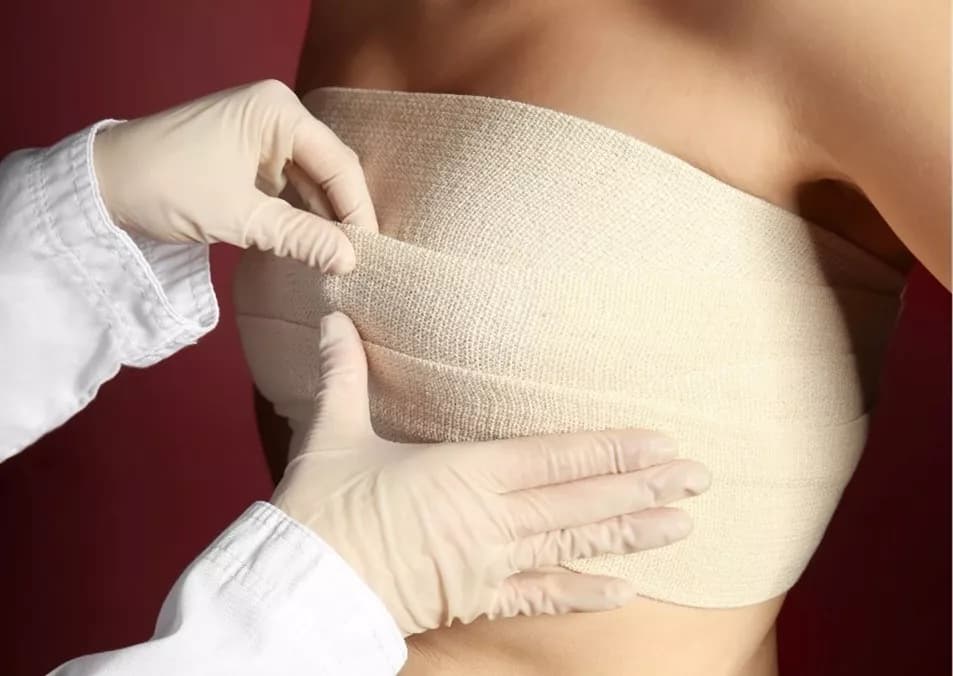Brustvergrößerung mit Straffung: Tipps zur Wahl des Implantats